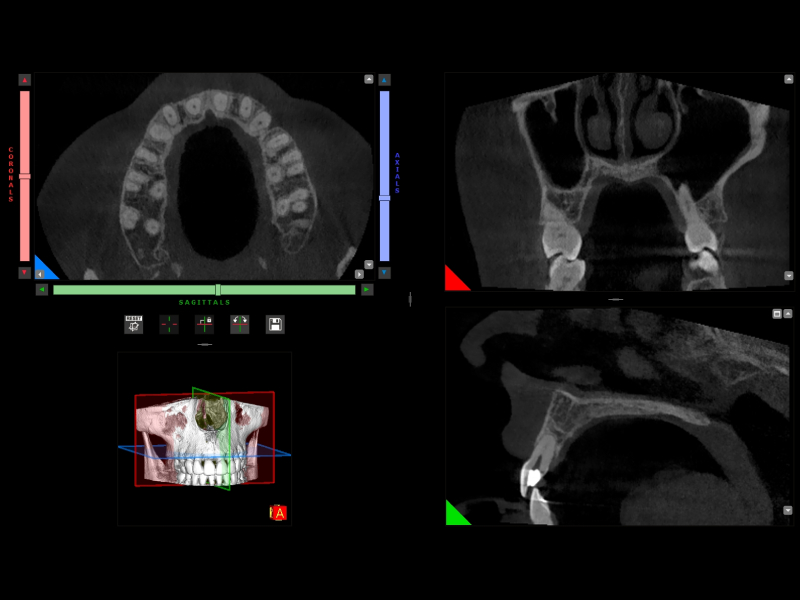 esame-CBCT